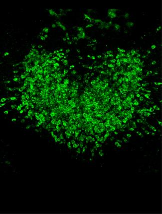 glp 1 heart GLP-1 use cuts atrial fibrillation risk regardless of weight loss