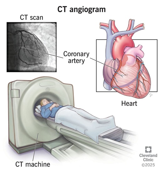 Cleveland Clinic Weston Hospital to Offer Free Cardiac Screenings to Broward County Residents