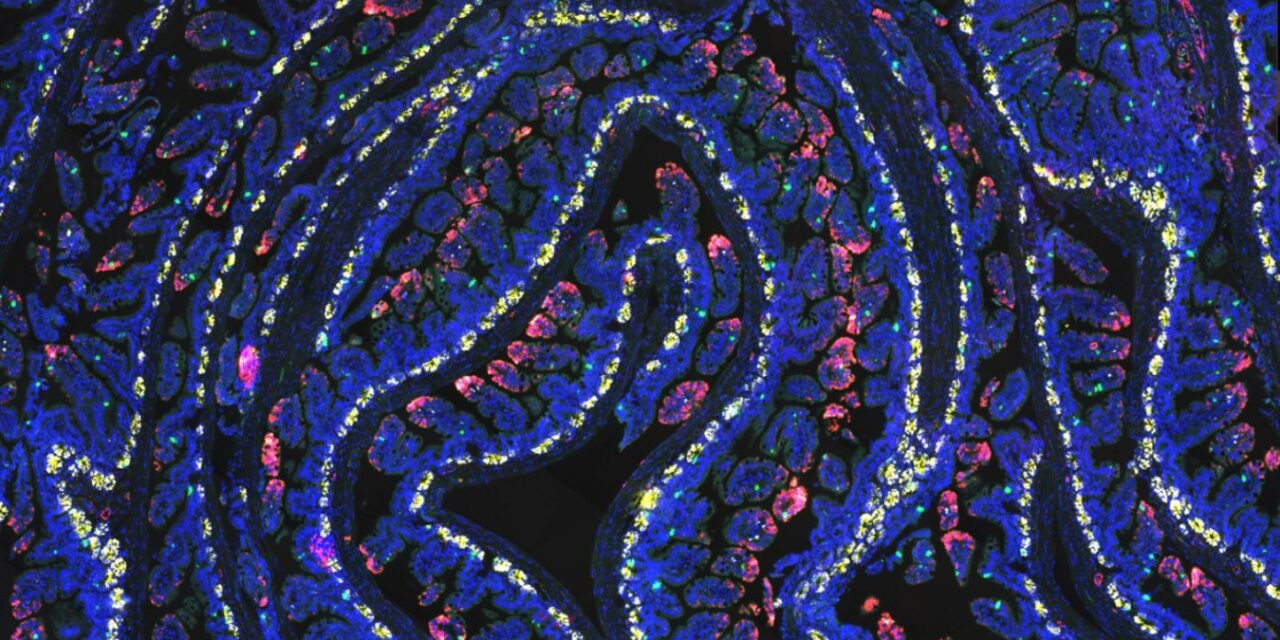 Fasting primes gut microbiome to improve intestinal recovery after radiation treatment