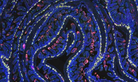 Fasting primes gut microbiome to improve intestinal recovery after radiation treatment