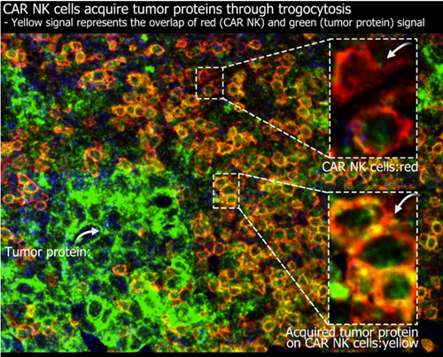 MD Anderson: Donor cord blood composition may influence CAR NK cell therapy outcomes