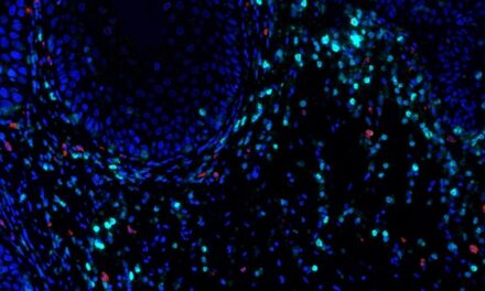 MD Anderson : Early inflammation signal drives oral cancer development, highlights path for immunoprevention