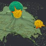 AI tool reveals what attracts immune cells to tumors and what keeps them away
